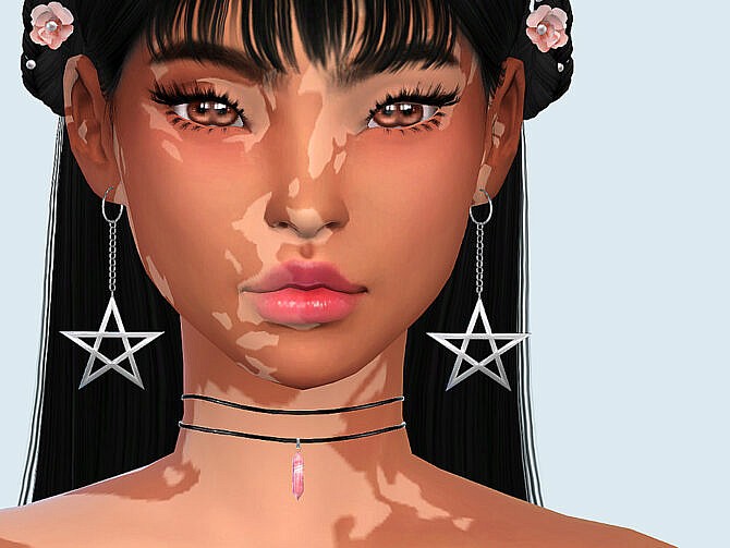 Skin Detail Vitiligo Set No. 2 by Saruin at TSR
