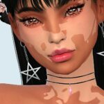 Skin Detail Vitiligo Set No. 2 by Saruin at TSR