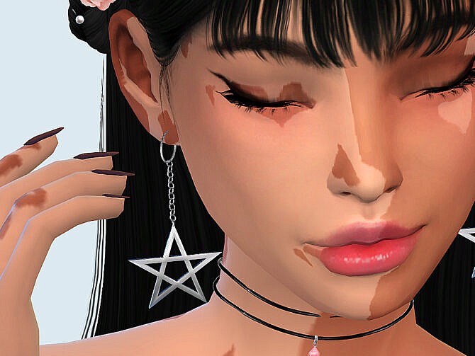 Skin Detail Vitiligo Set No. 2 by Saruin at TSR
