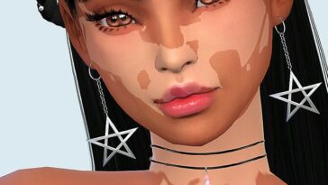 Skin Detail Vitiligo Set No. 2 by Saruin at TSR