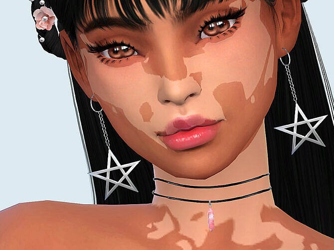 Skin Detail Vitiligo Set No. 2 by Saruin at TSR