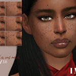 IMF Freckles + moles N.18 by IzzieMcFire at TSR