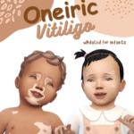 Oneiric vitiligo by melichryses Updated for infants by tinysimmer